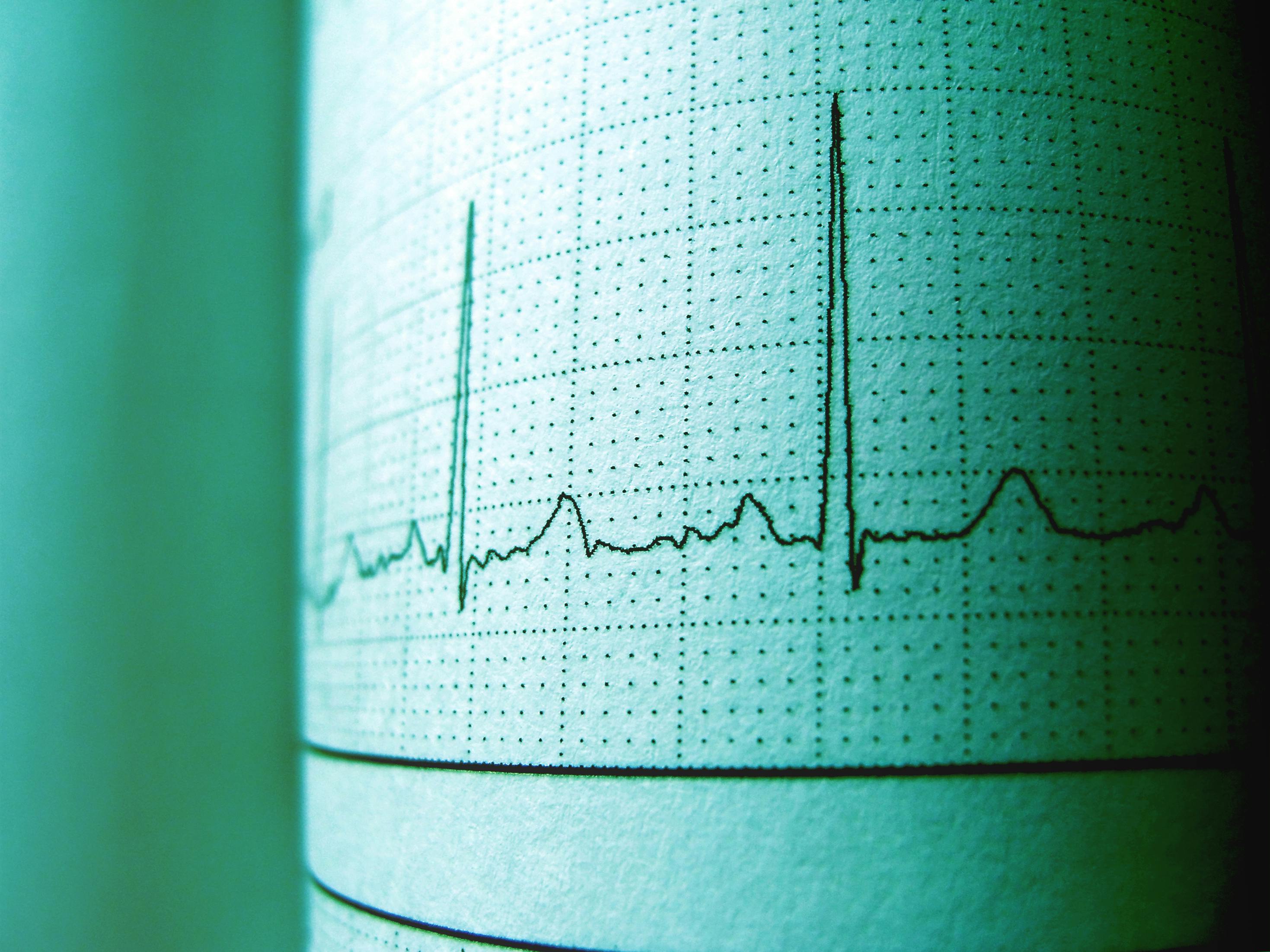 Heart monitor results on graph paper
