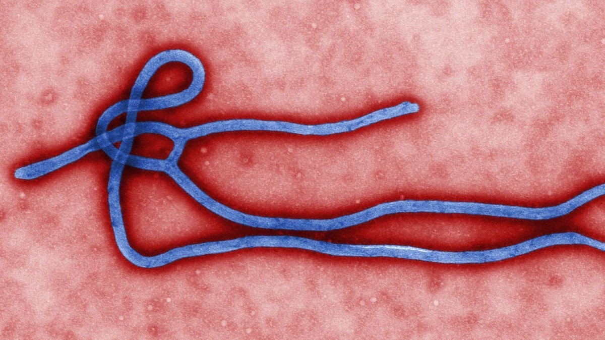 The Ebola virus