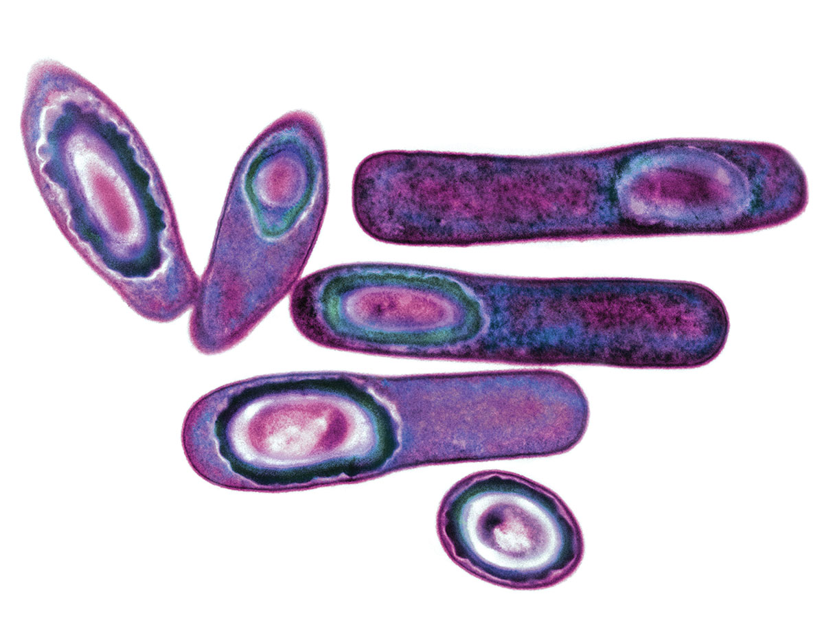 CLOSTRIDIUM DIFFICILE // IMAGE BY BIOMEDICAL IMAGING UNIT, SOUTHAMPTON GENERAL HOSPITAL/SCIENCE SOURCE