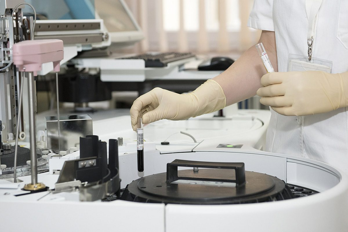 Testing blood in tubes