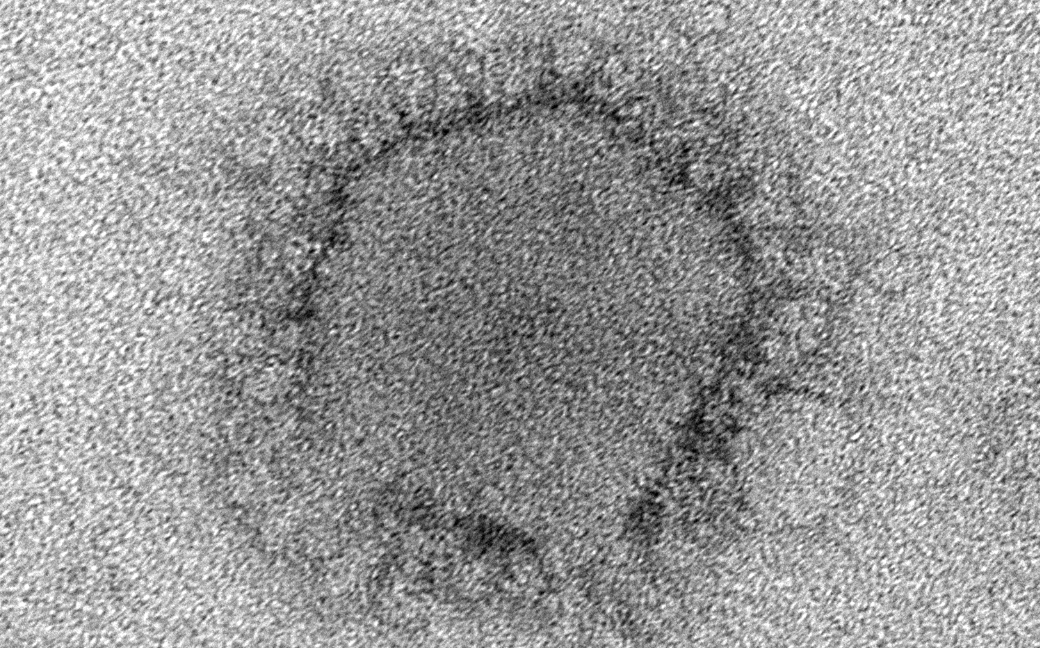 Coronavirus