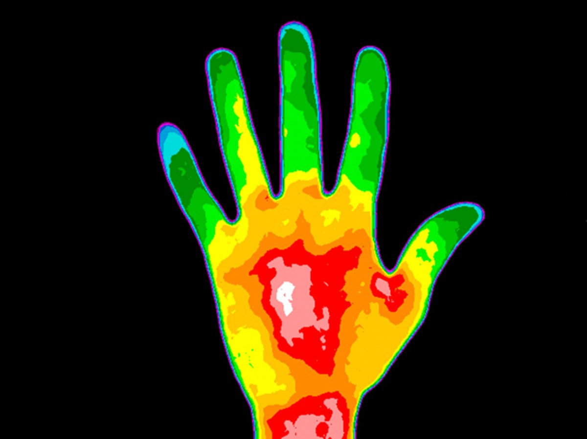 A thermal image of a human hand has glowing regions of blue, green, yellow and red.