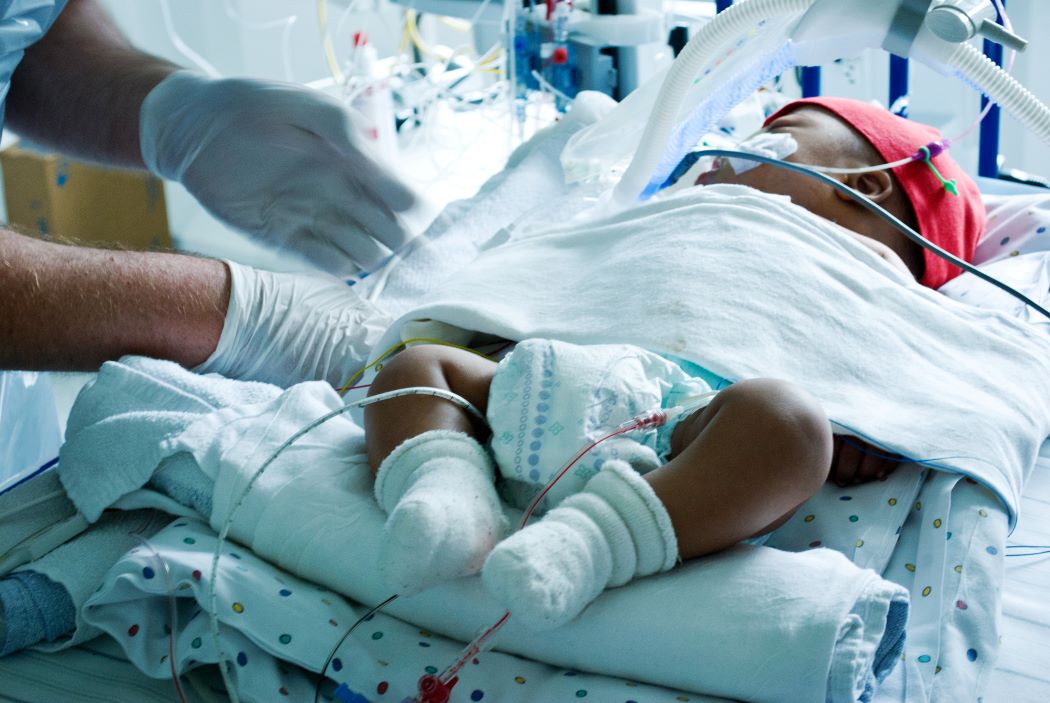 A sick baby in hospital, hooked up to many wires and tubes.