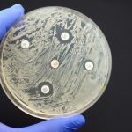 Antibiotic sensitivity test done in a petri dish.