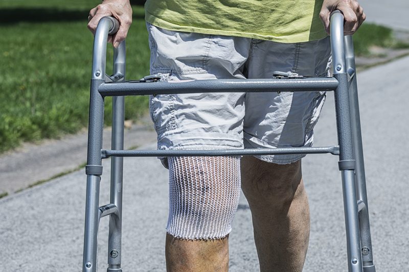 A person with stitches on their knee, which is wrapped in gauze, uses a walker.
