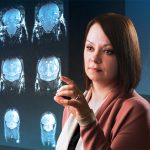 Dr. Tamra Werbowetski-Ogilvie points at images of the brain.
