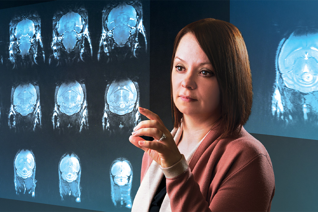 Dr. Tamra Werbowetski-Ogilvie points at images of the brain.