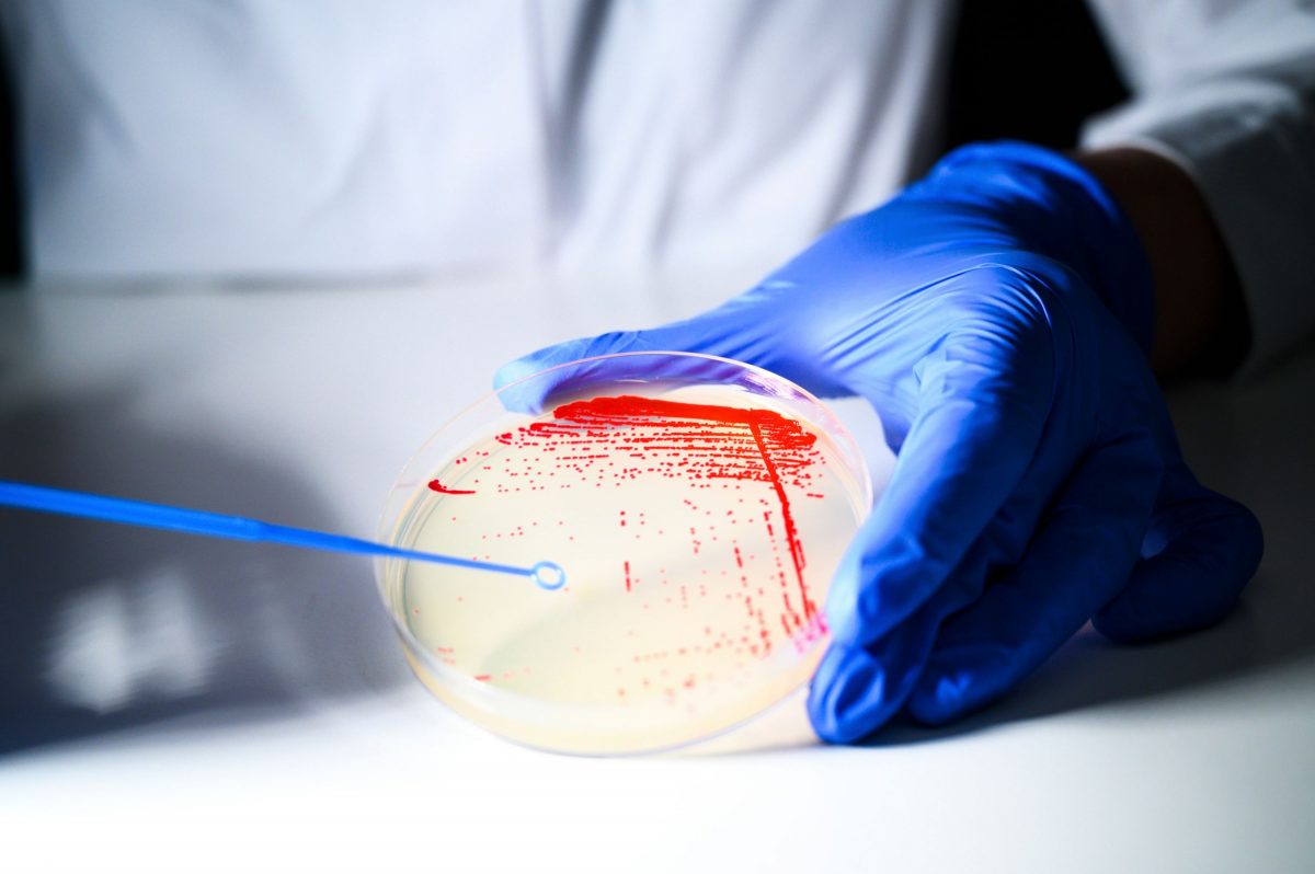 Bacterial colonies on agar plate