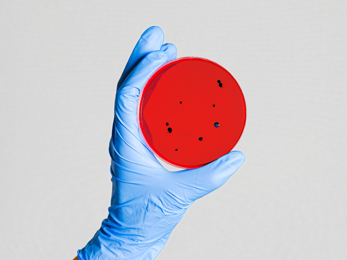 A hand with a blue glove holding out a red plate with some black dots.