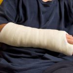 A child with their arm in a cast to the elbow.